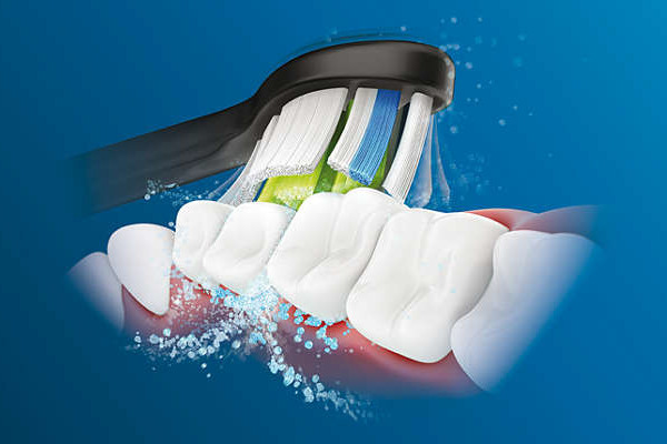 Szczoteczka elektryczna Philips Sonicare HX685153